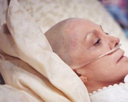 Varför drömmer du om en person som har cancer?